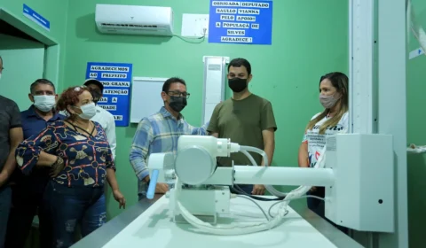 Emenda de Saullo Vianna viabiliza compra de equipamento de raio-x em Silves