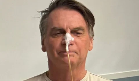 Bolsonaro continua na UTI e inicia alimentação limitada após cirurgia