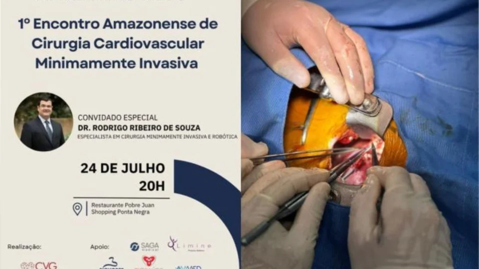 Manaus sedia 1º Encontro Amazonense de Cirurgia Cardiovascular Minimamente Invasiva